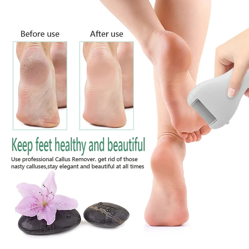 Electric Pedicure Foot