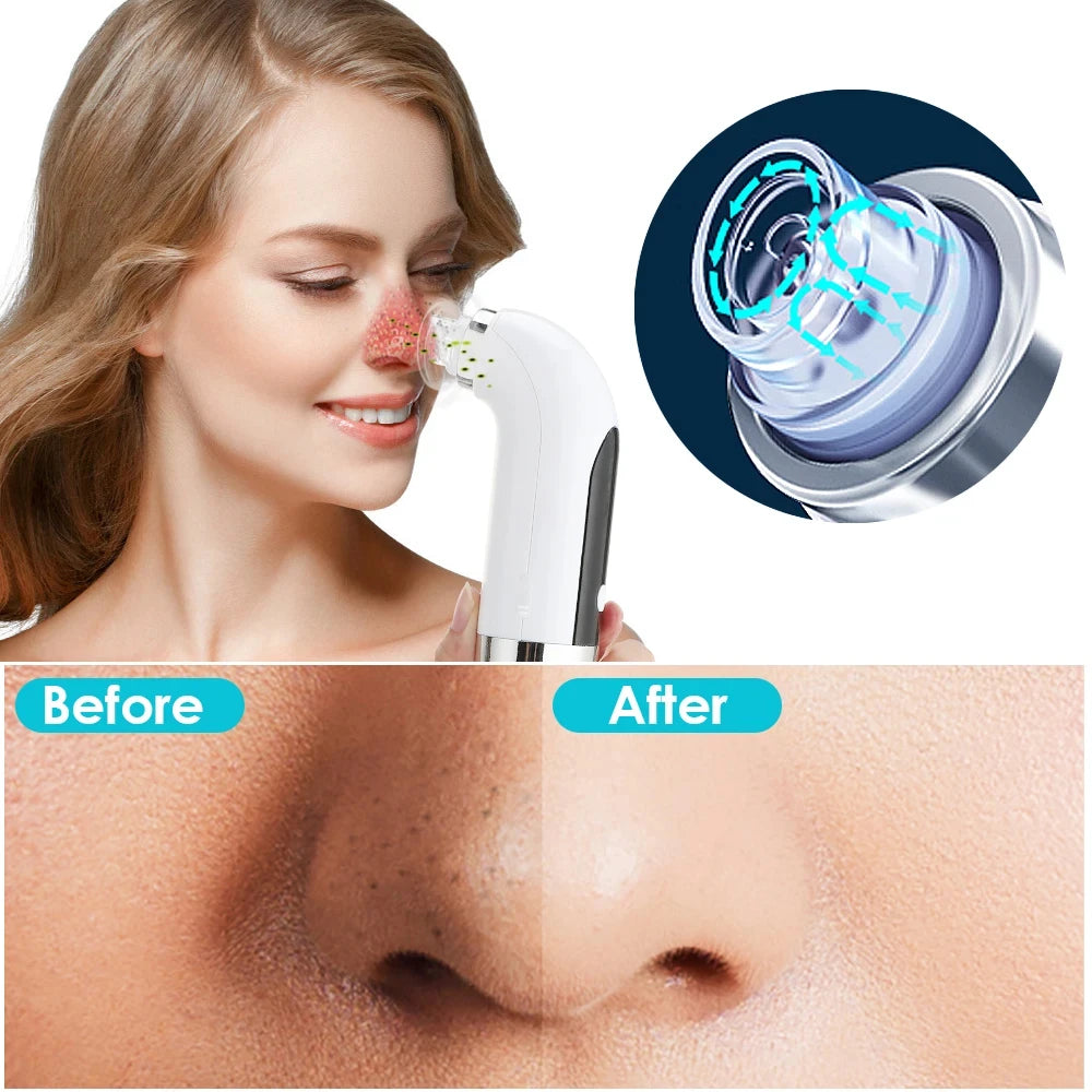 Electric Small Bubble Blackhead Remover