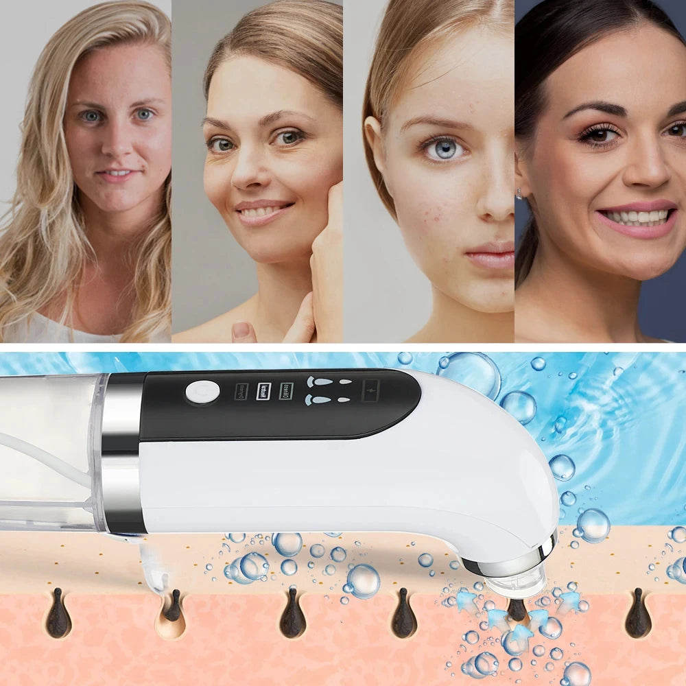 Electric Small Bubble Blackhead Remover