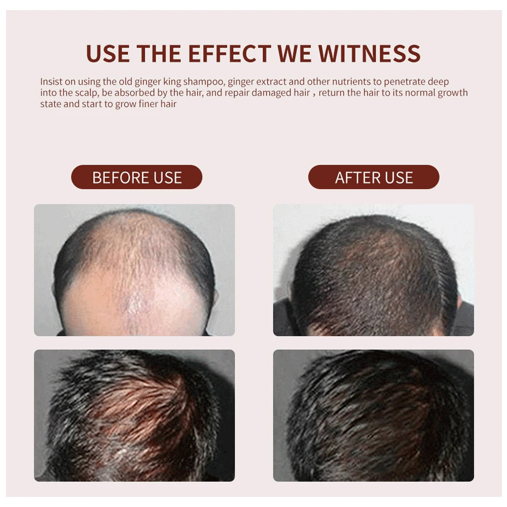 Oil Natural Anti Hair Loss